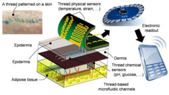 智能缝合技术 实时监控伤口恢复状态并连接手机的新突破